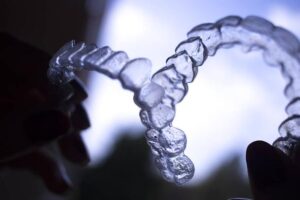 Affordable Invisalign In Perth And How They Are Improving Your Smile
